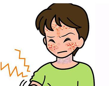 过敏老是发作怎么办【厦门广肤皮肤病专科医院好不好】